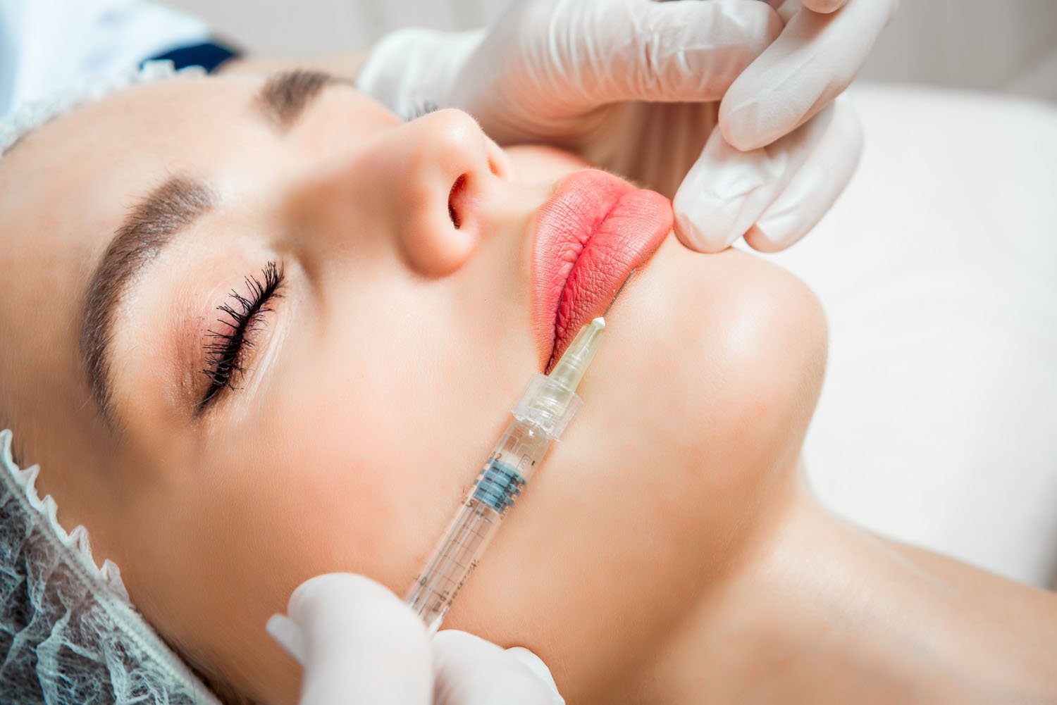 botox behandeling